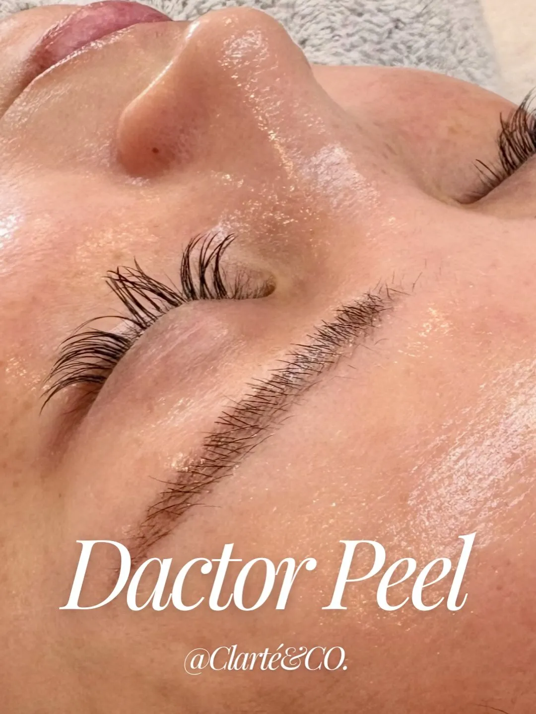 【✔ララピール超え!?🫧】